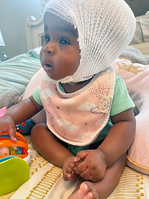 CHoR patient Kamryn with her head wrapped in gauze after surgery