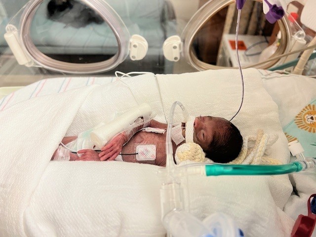 Lennox weighing less than a pound in the CHoR NICU