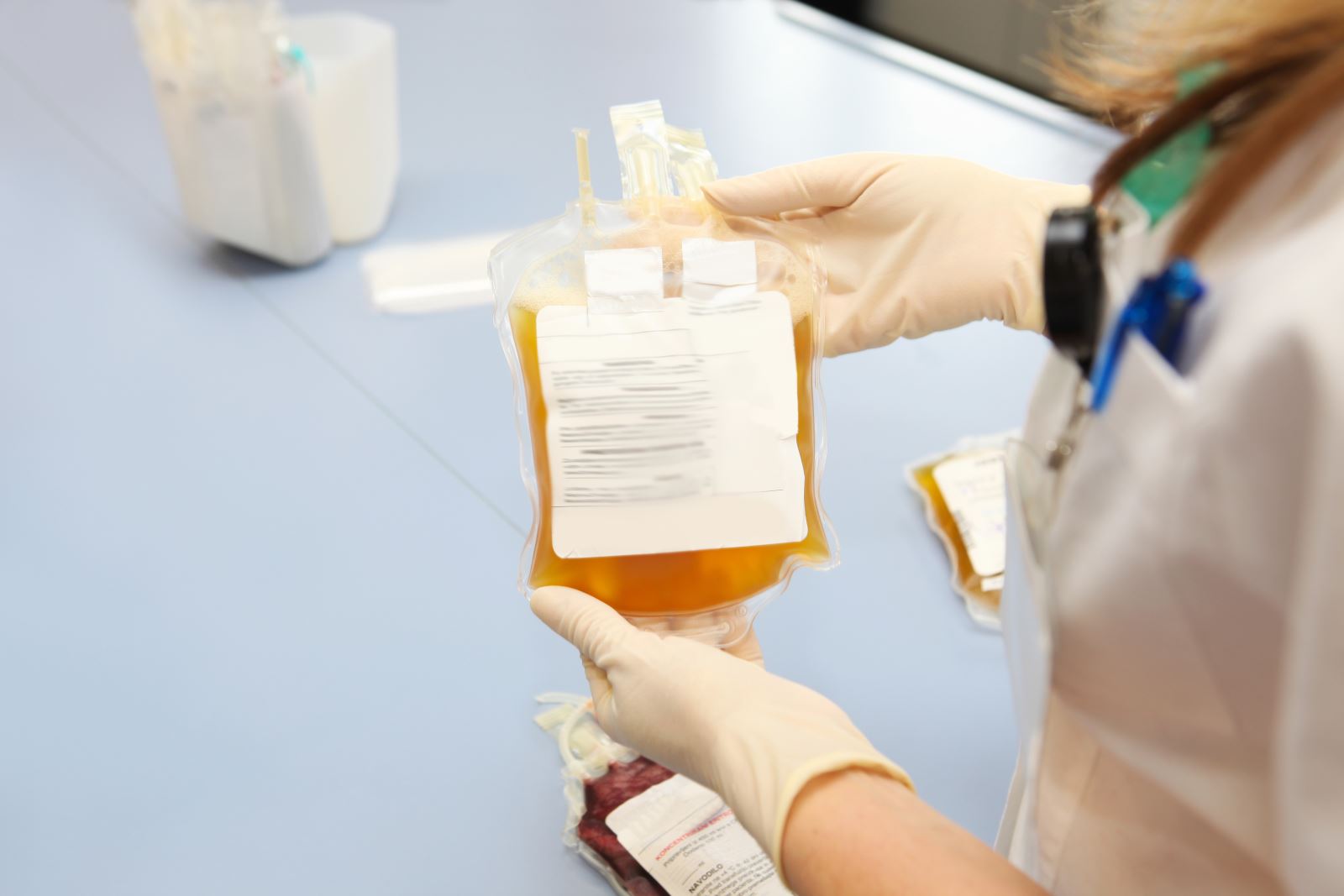 COVID-19 recovered patients can donate plasma