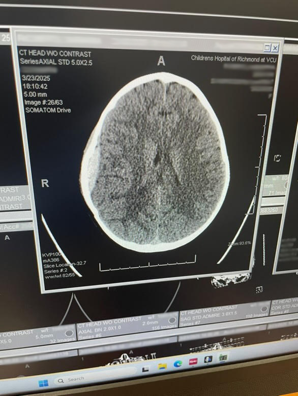Brain scan