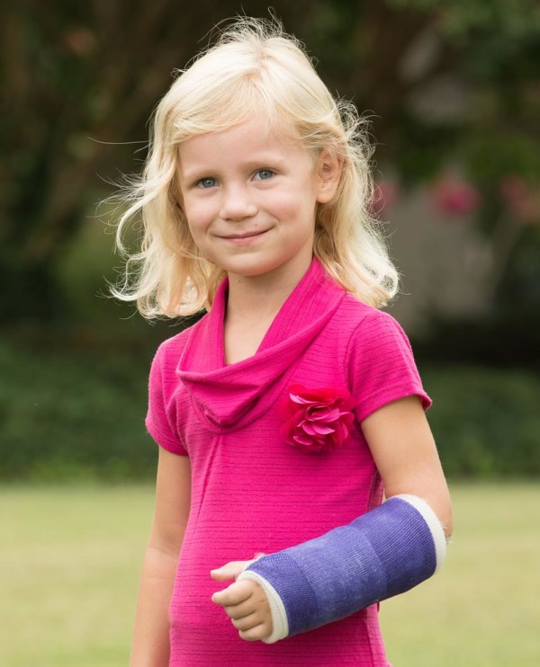 broken vs bruised bones