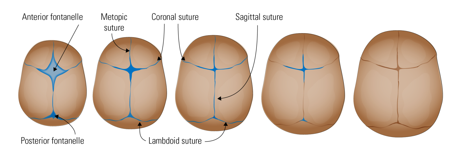 Drawing of fontanelle and sutures